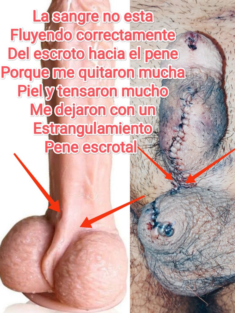 urologo mariano oropeza medica sur urologo mariano oropeza medica sur