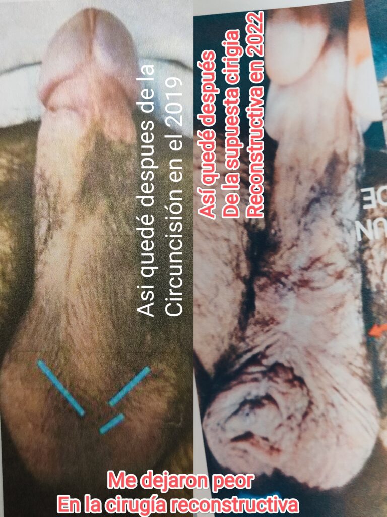 urologo mariano oropeza aguilar urologo mariano oropeza aguilar